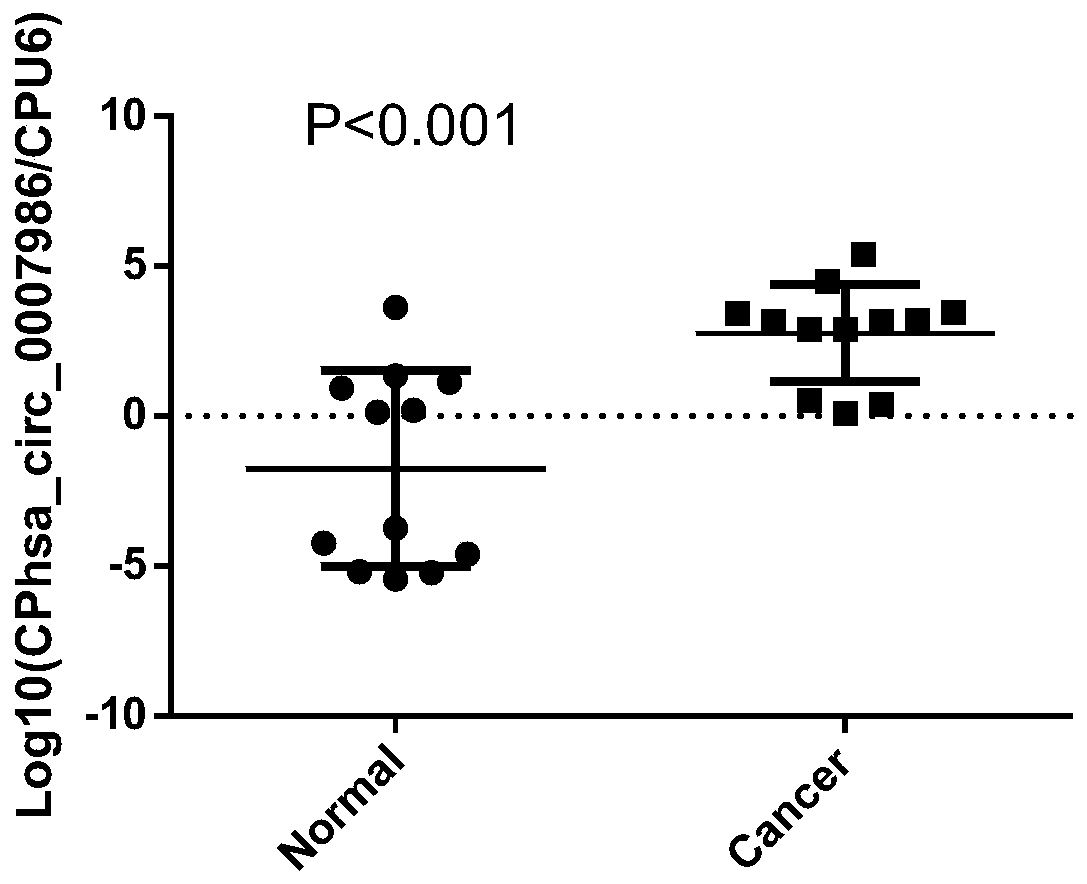 Detection of hsa_circ_0007986 in the serum of patients with esophageal cancer as a new biomarker method and application