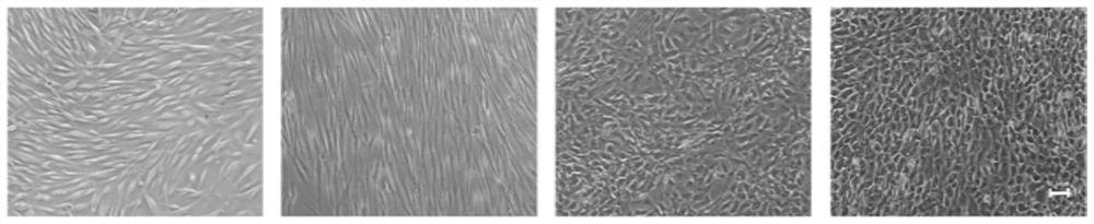 Preparation method of liver organoid