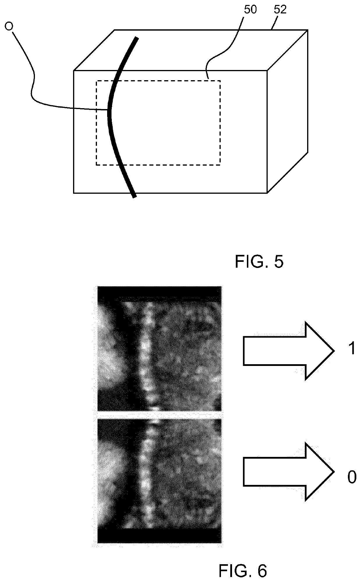 Fetal ultrasound image processing