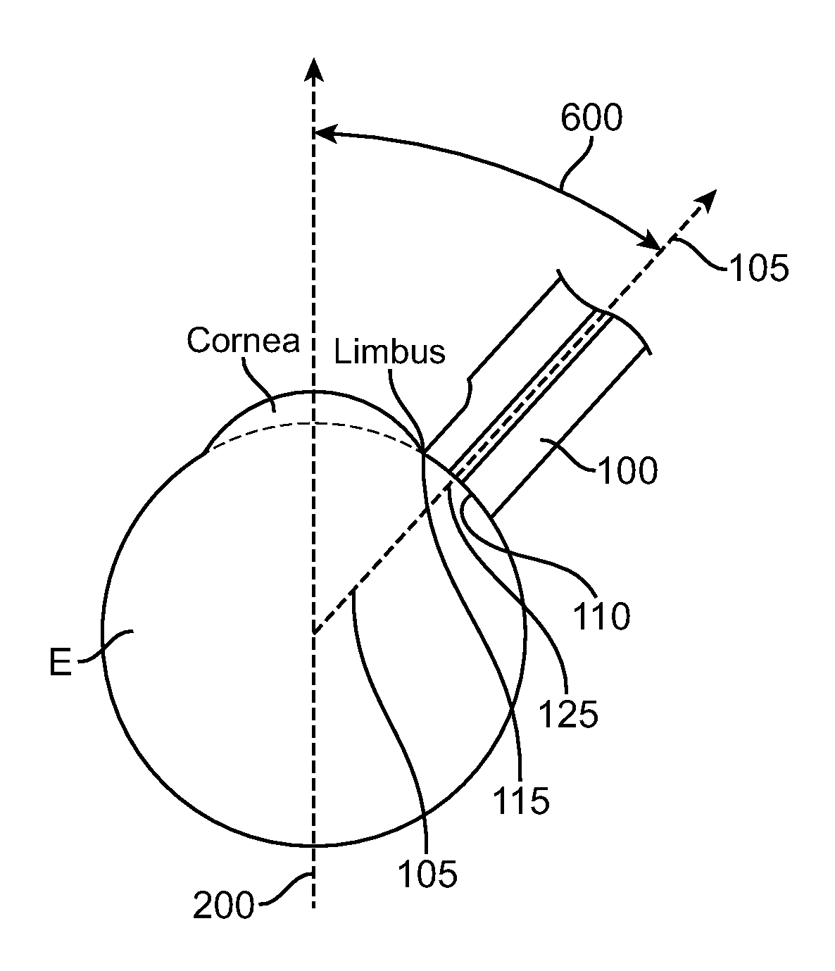 Contact Probe for the Delivery of Laser Energy