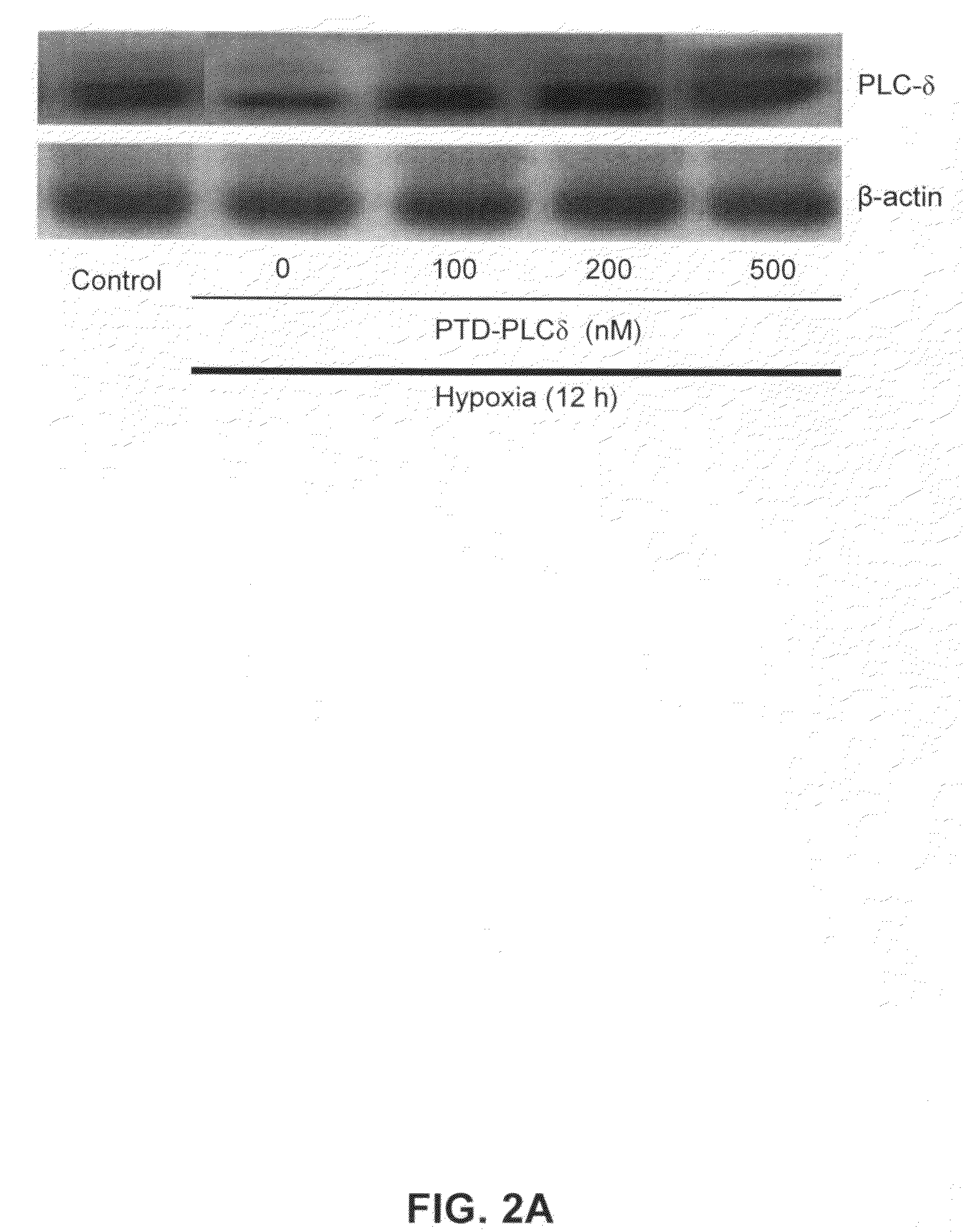 Pharmaceutical composition for alleviation and treatment of ischemic conditions and method for delivering the same