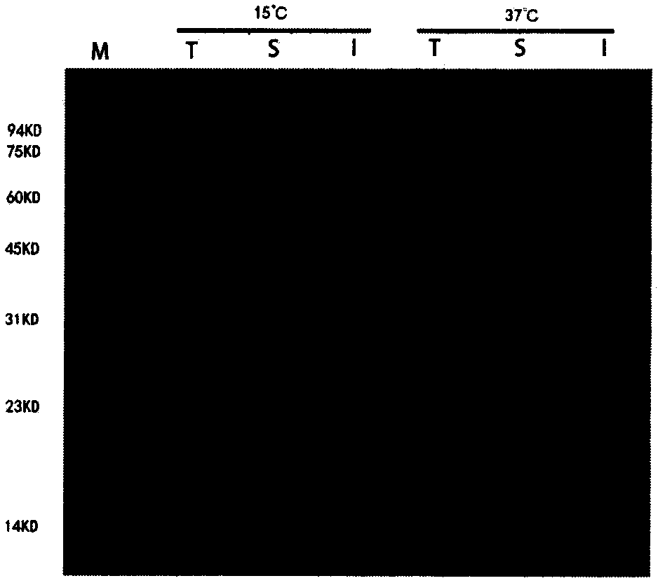 Recombinant T4 bacteriophage polynucleotide kinase (T4 PNK) and preparation method thereof