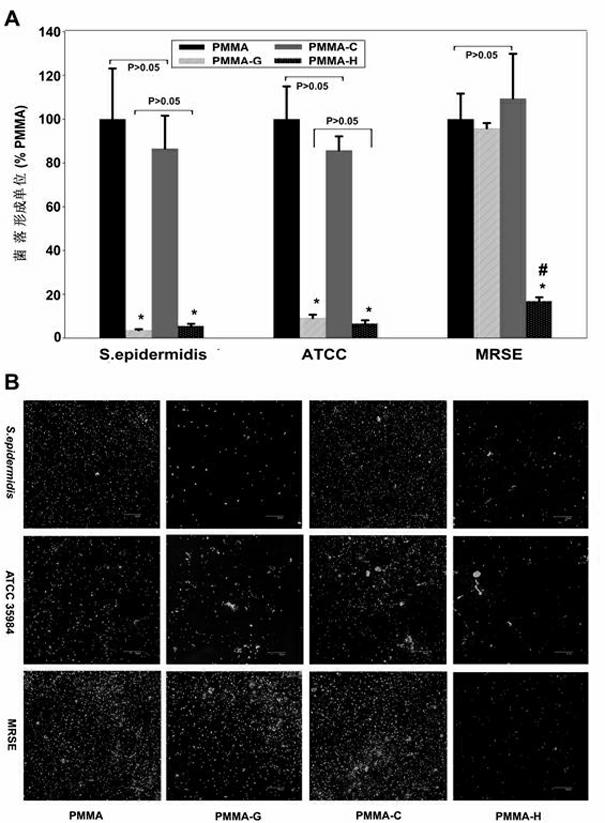 Anti-infection PMMA (polymethyl methacrylate) bone cement for composite chitosan quaternary ammonium salt