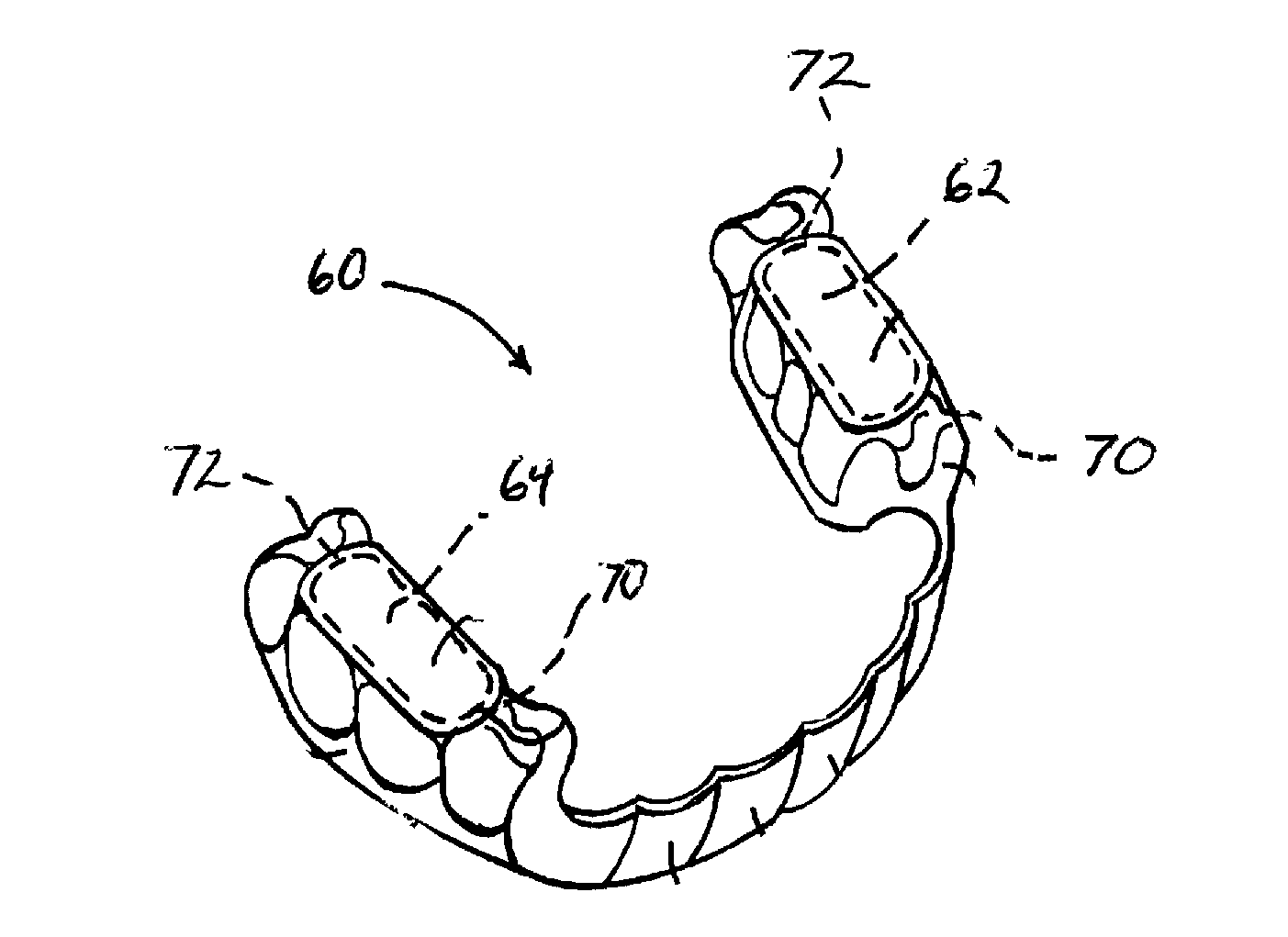 Methods and apparatus for reduction of lactate