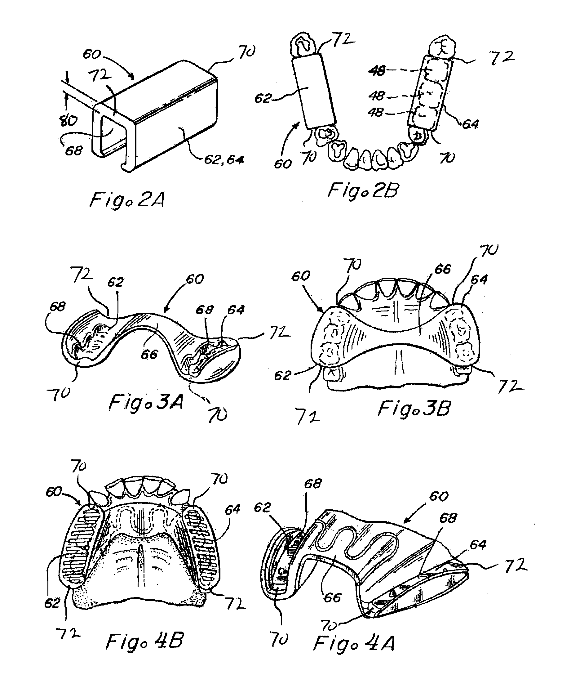 Methods and apparatus for reduction of lactate