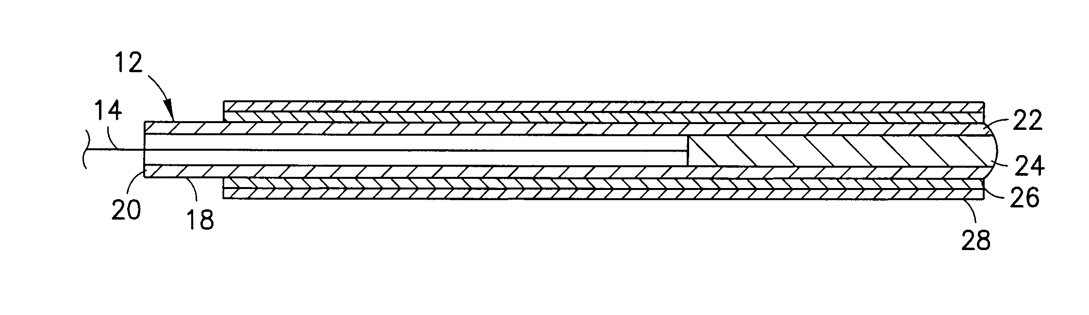 Device and Method for Inhibiting Movement of a Medical Device in a Patient