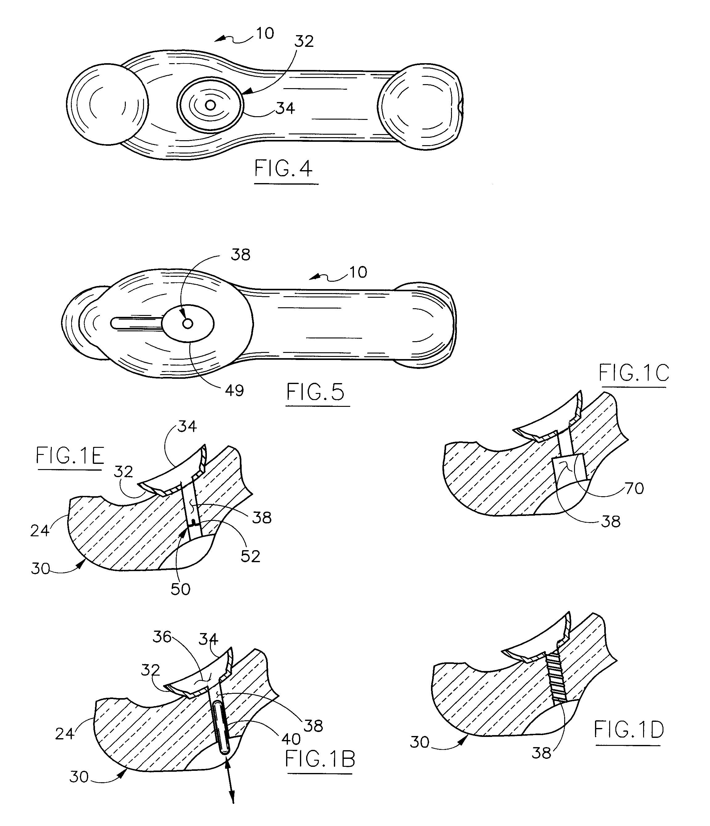 Erogenic stimulator