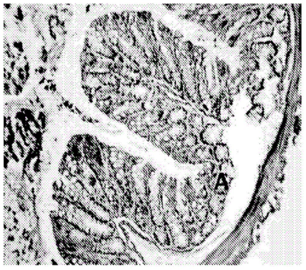 Anti-cxcl9, anti-cxcl10, anti-cxcl11, anti-cxcl13, anti-cxcr3 and anti-cxcr5 agents for inhibition of inflammation