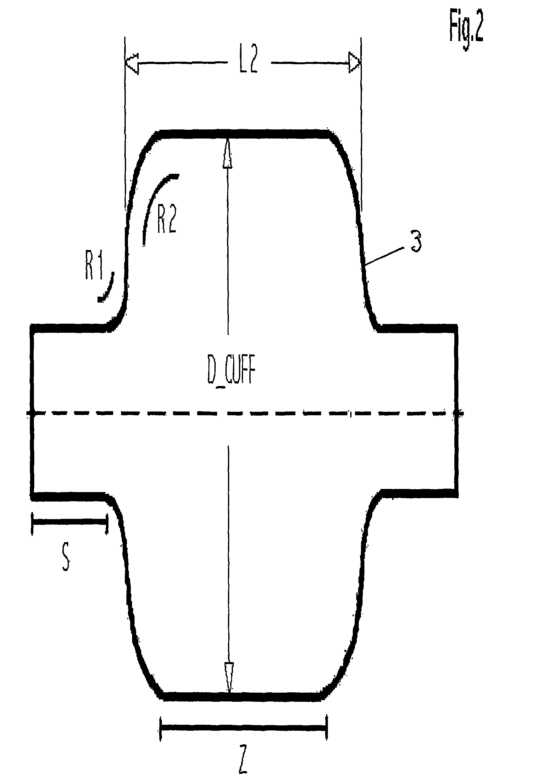 Tracheal ventilation device