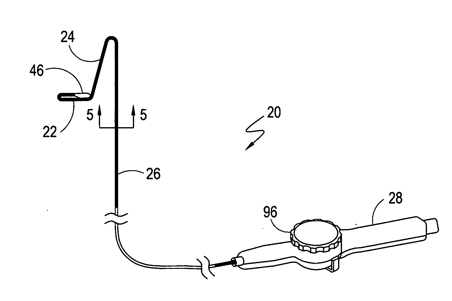 System for bi-directionally controlling the cryo-tip of a cryoablation catheter