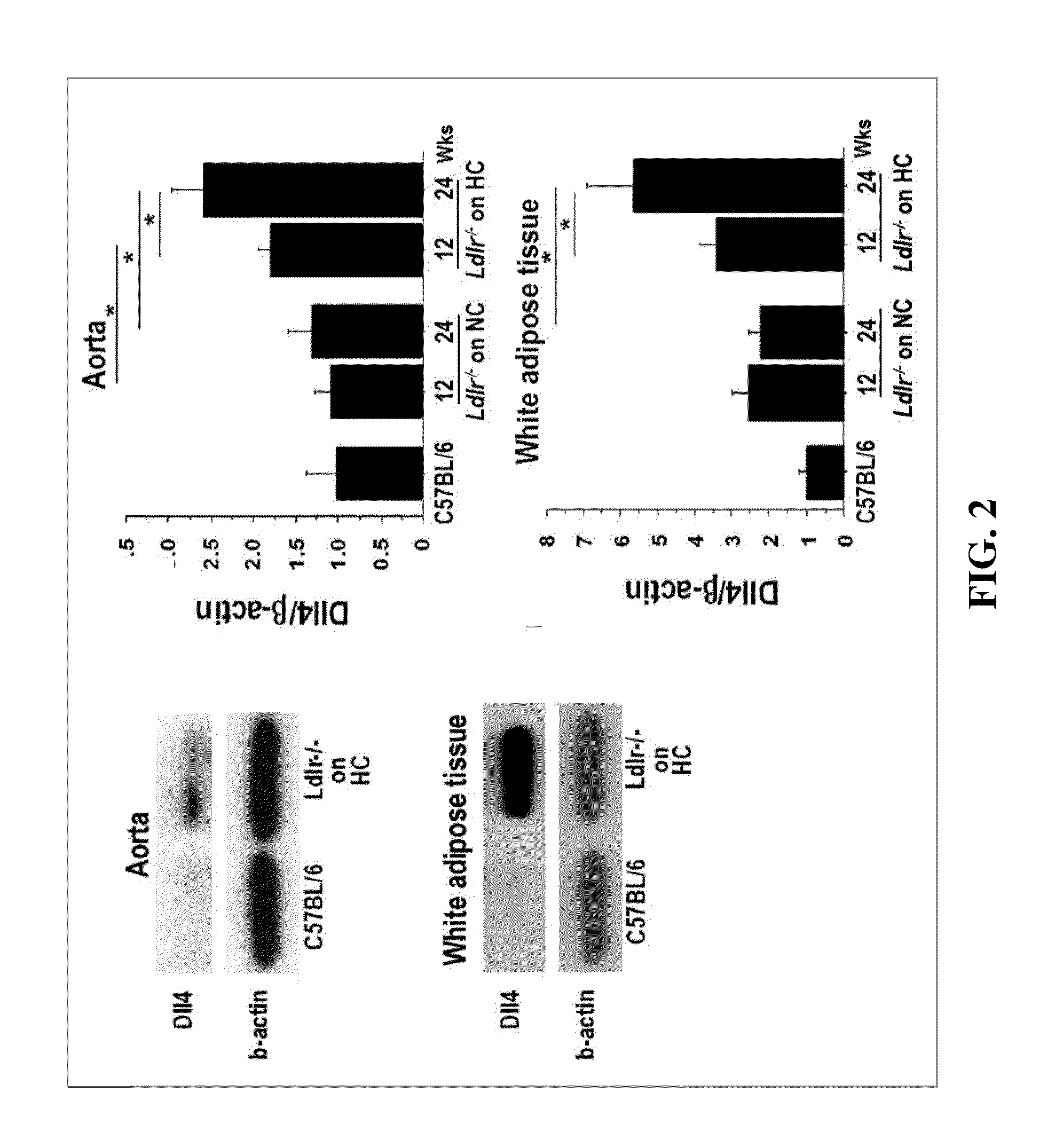 Notch inhibition in the treatment and prevention of a metabolic disease or disorder and cardiovascular complications thereof