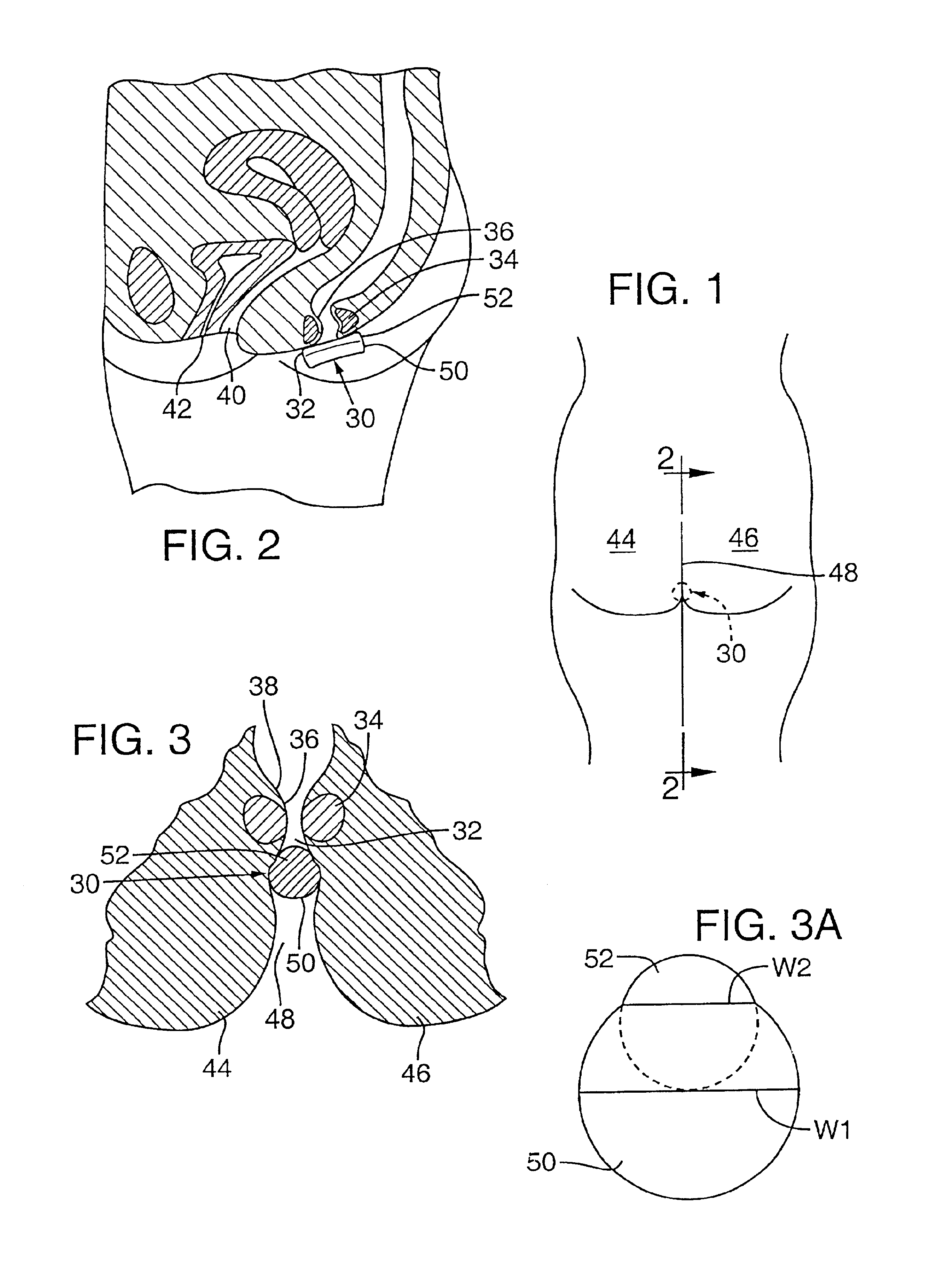 Administration of therapeutic or diagnostic agents using interlabial pad