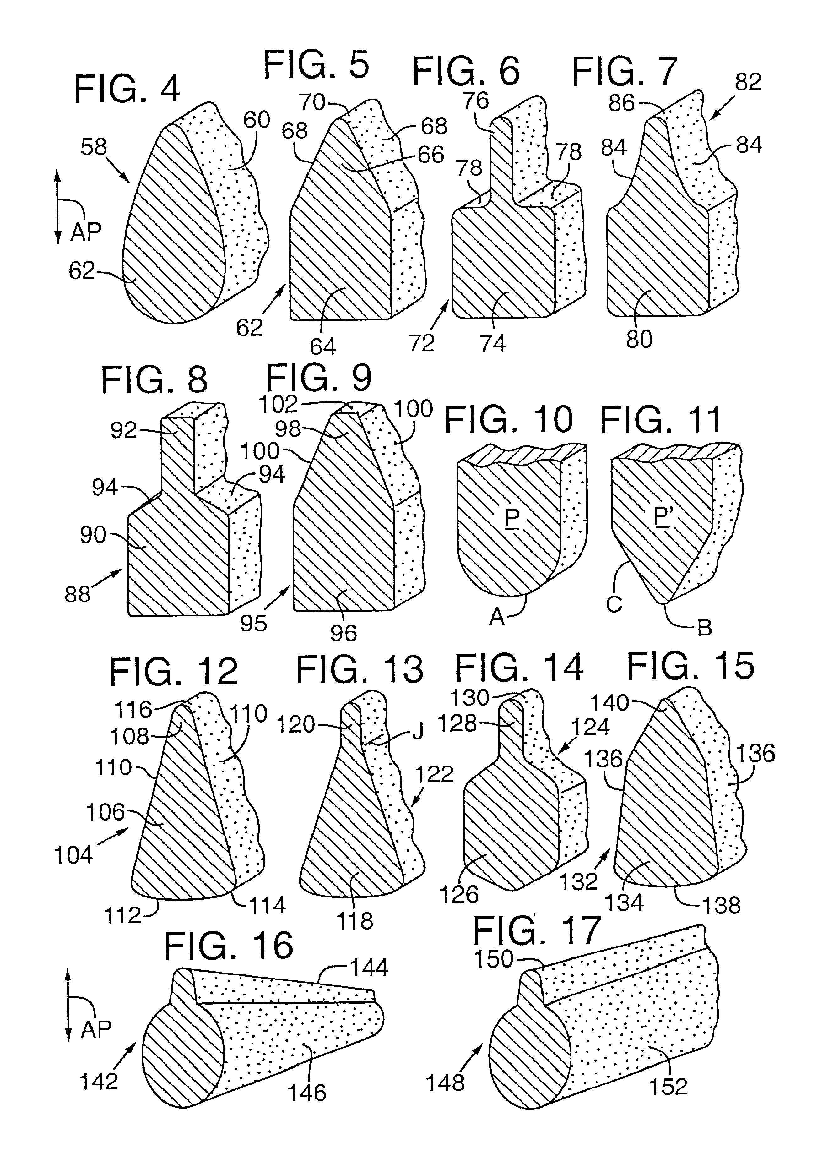 Administration of therapeutic or diagnostic agents using interlabial pad