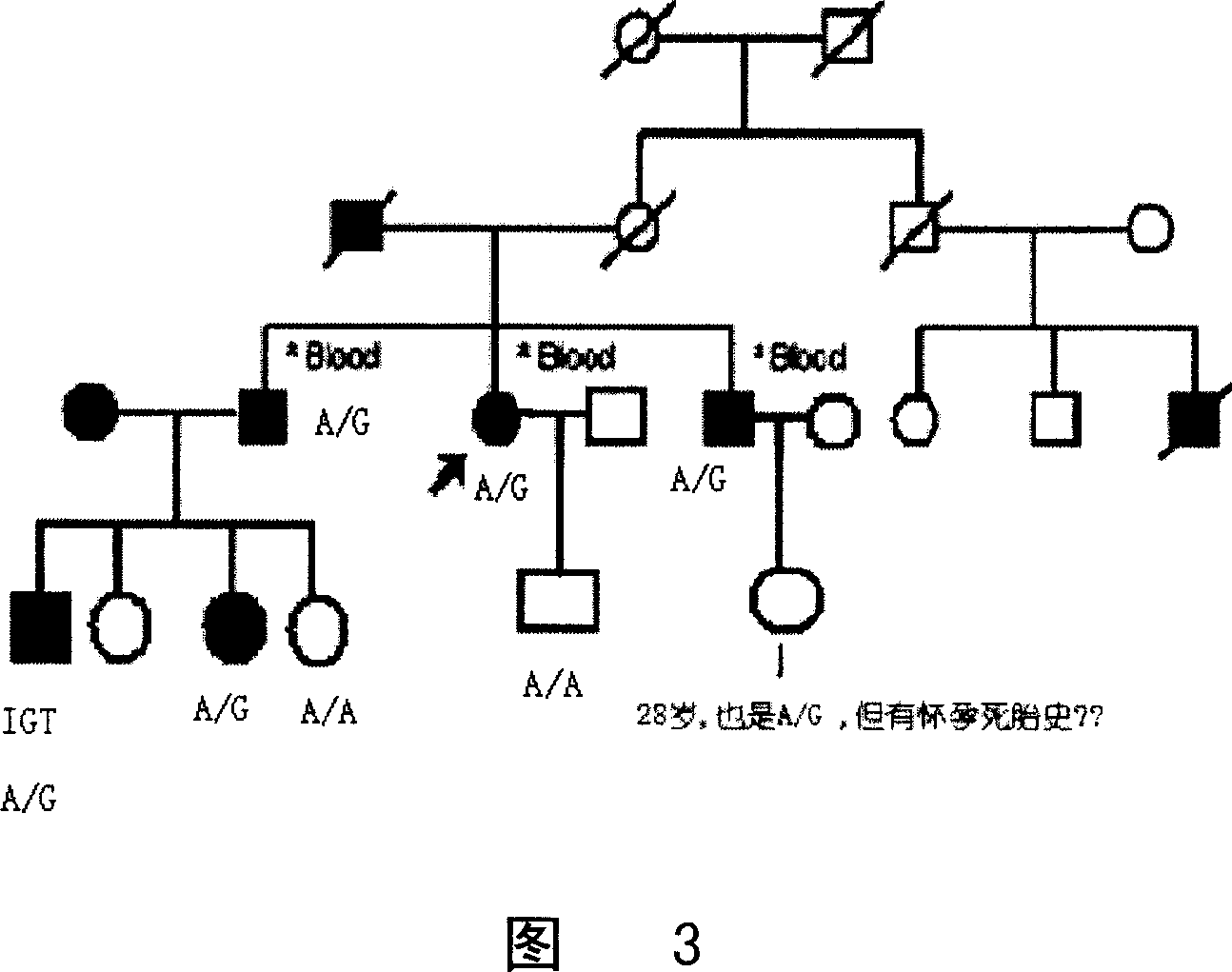 Adipocyte differentiation related protein gene and relativity with diabetes type2