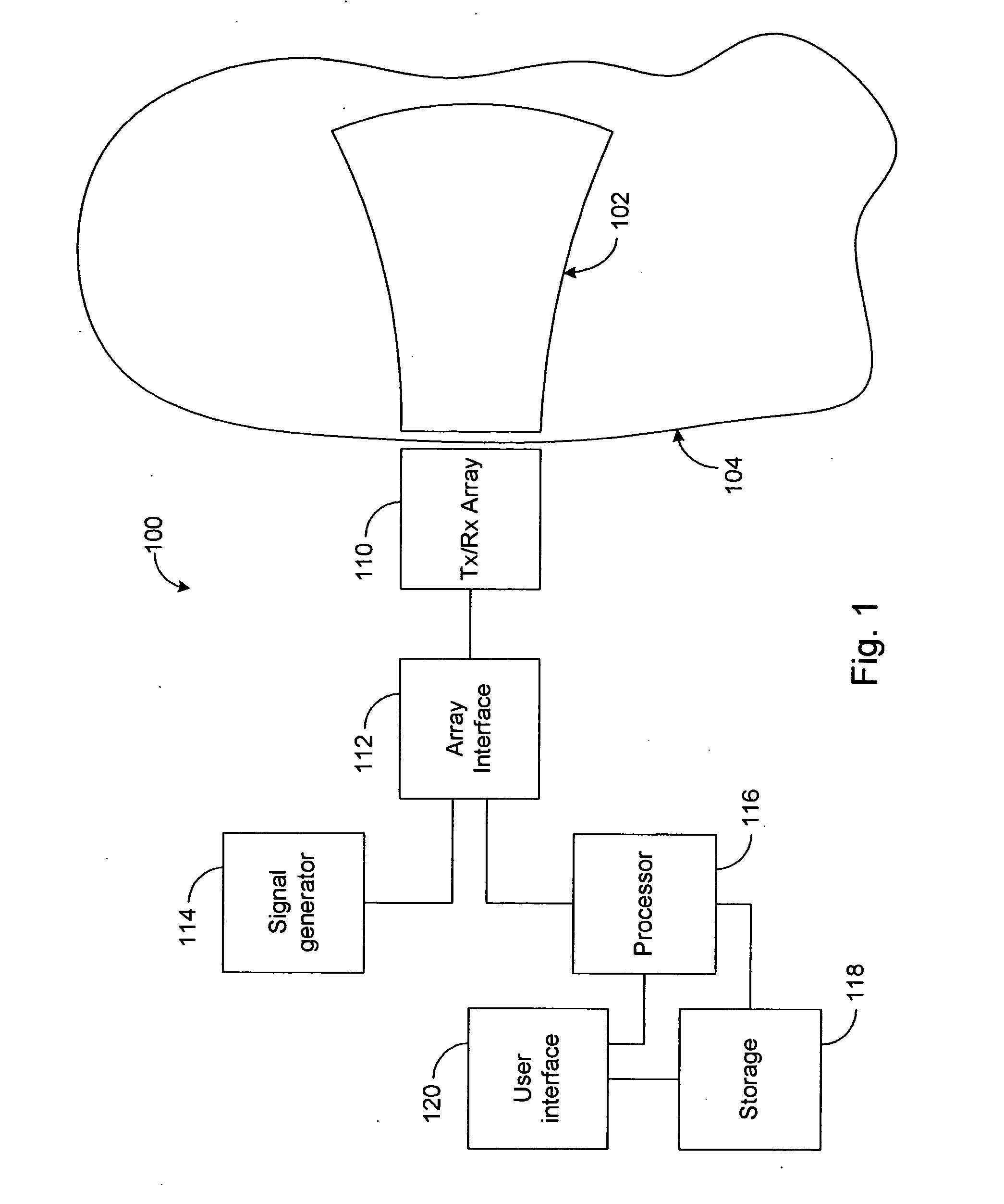 Systems and methods for ultrasound imaging