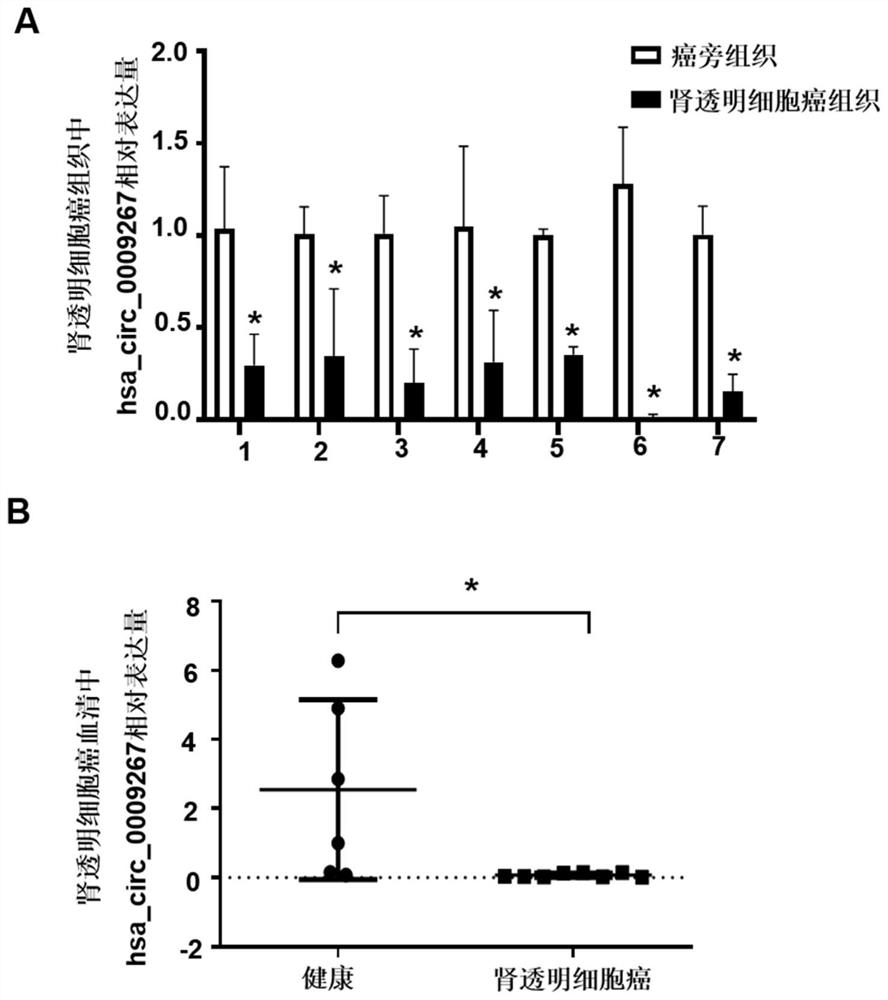 A circRNA biomarker, screening method and diagnostic kit for renal clear cell carcinoma