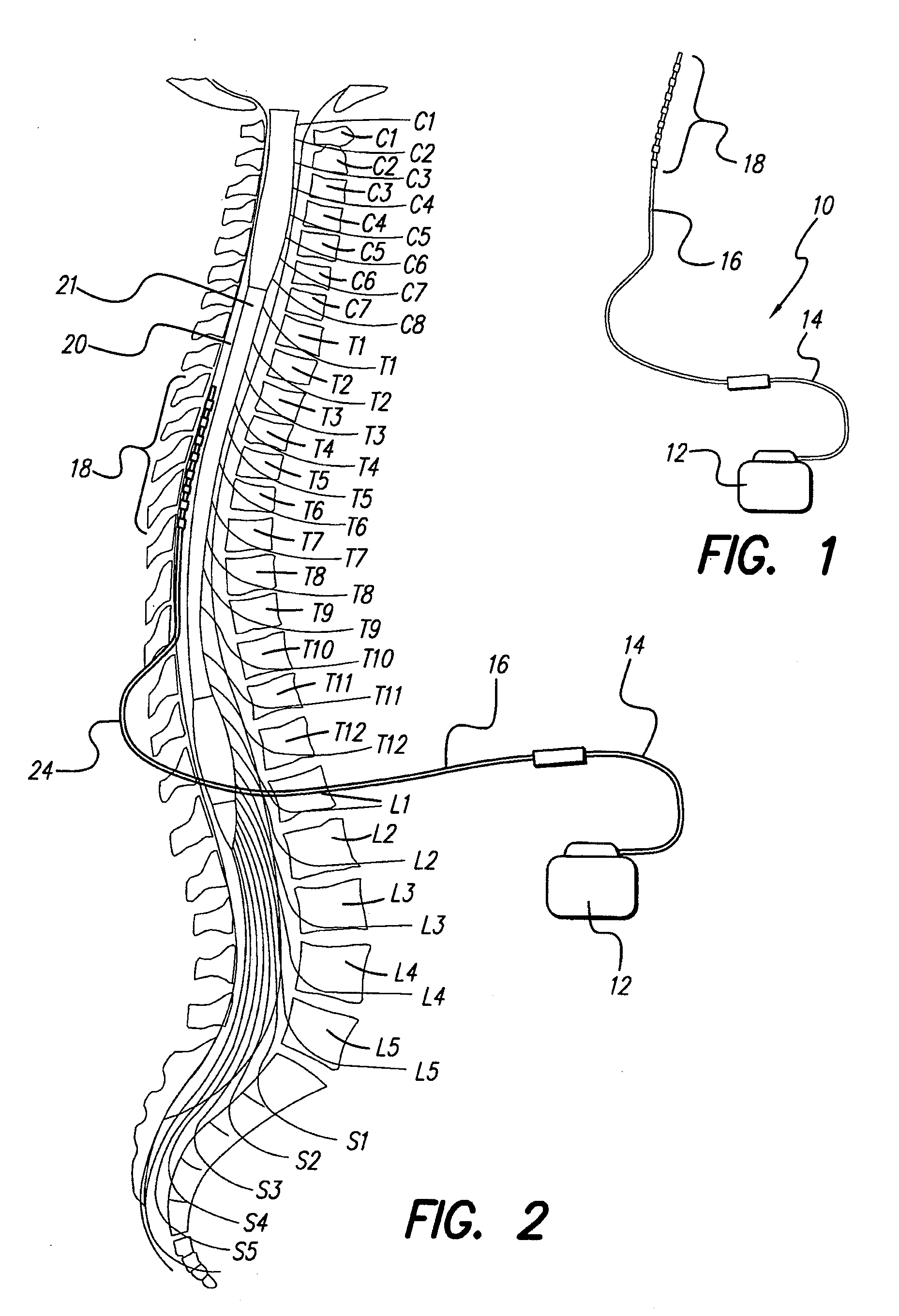 Method for optimizing search for spinal cord stimulation parameter setting