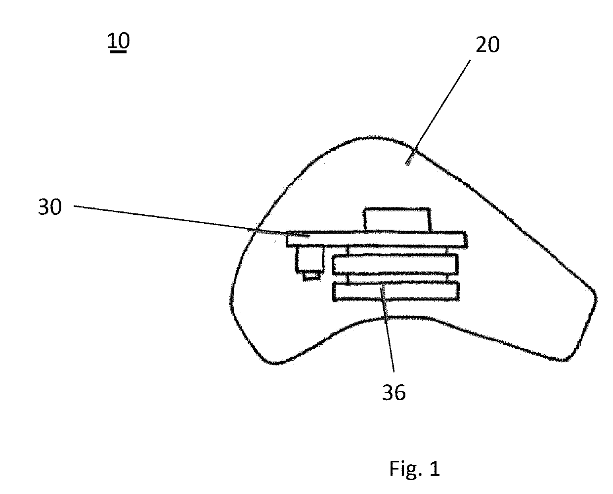 Devices AMD methods for brain stimulation