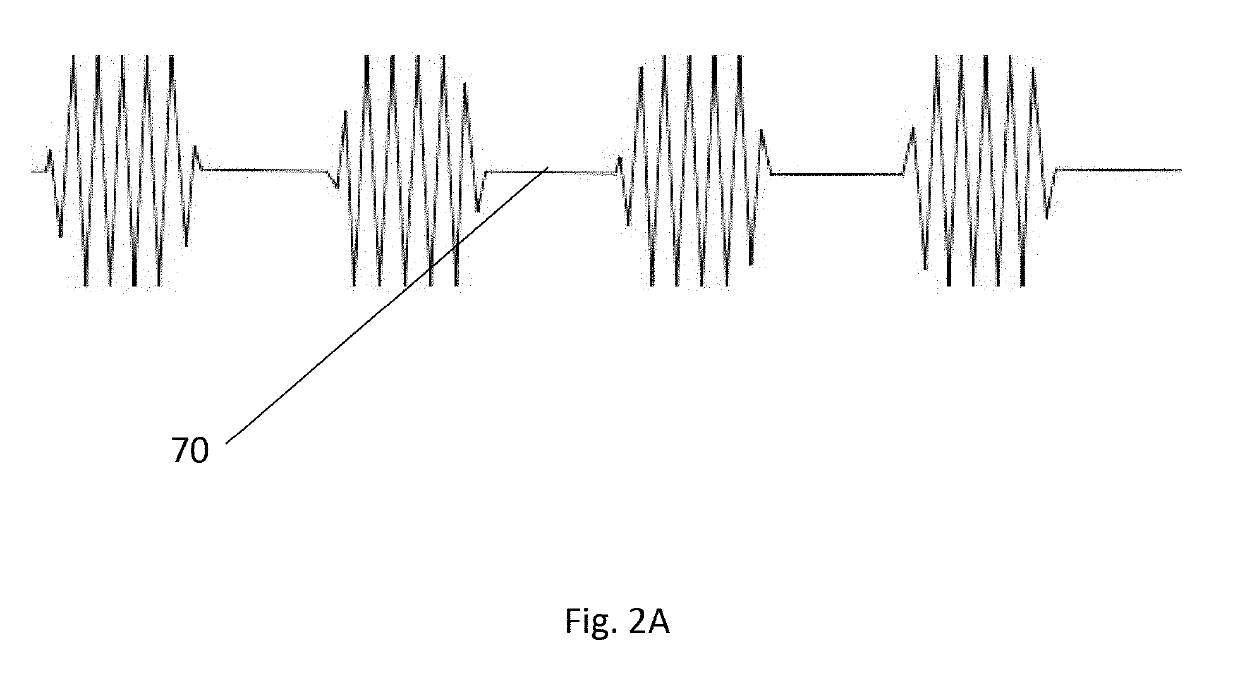 Devices AMD methods for brain stimulation