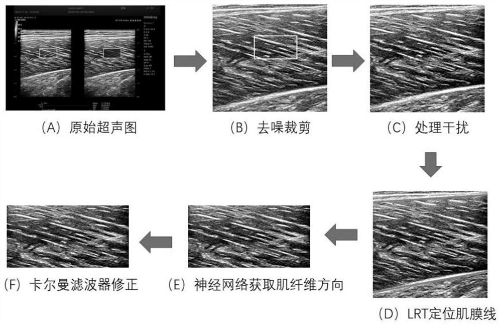 Method for automatically tracking muscle feather angle by combining convolutional neural network and Kalman filtering