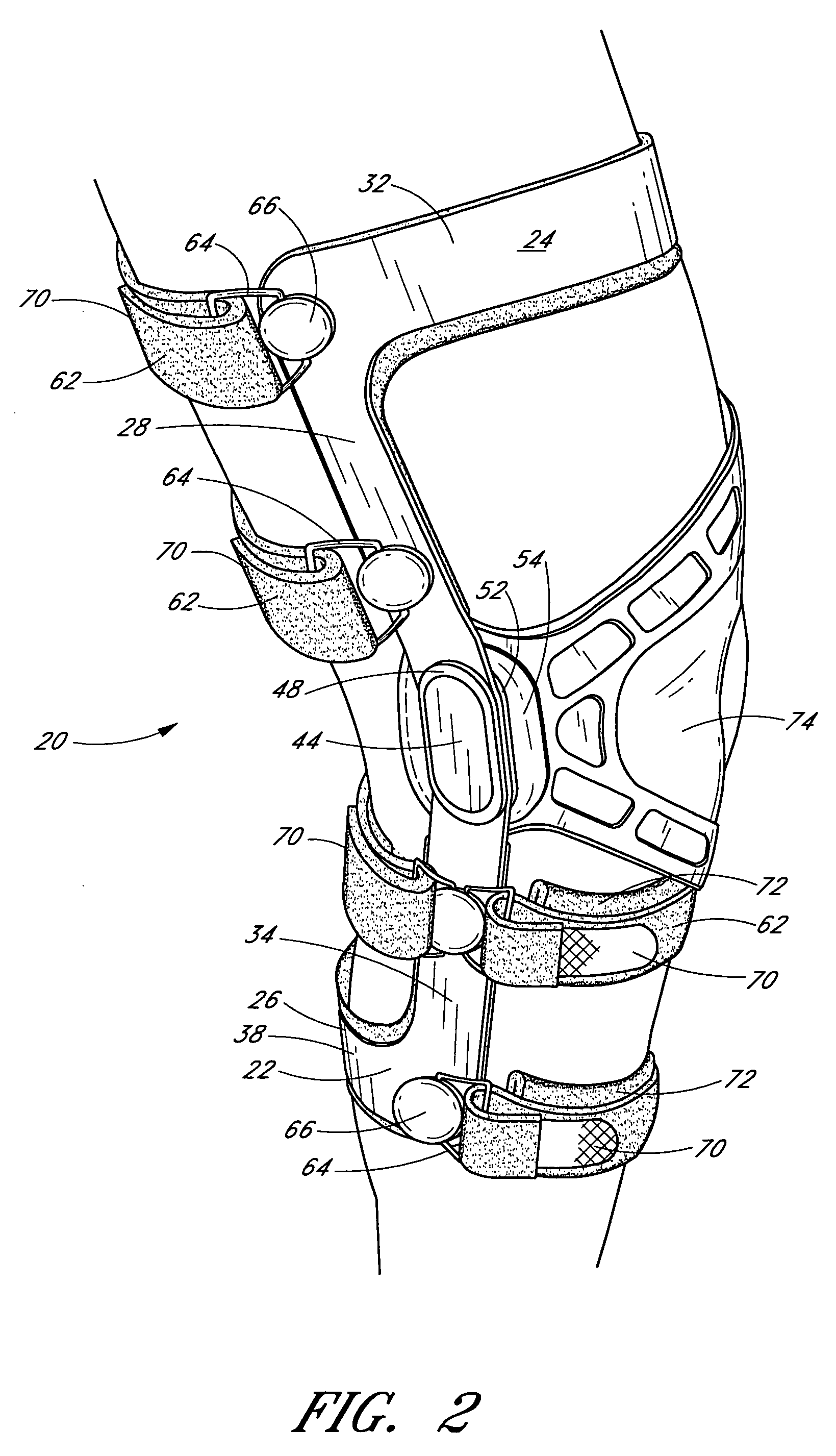 Knee brace having a rigid frame and patellofemoral support