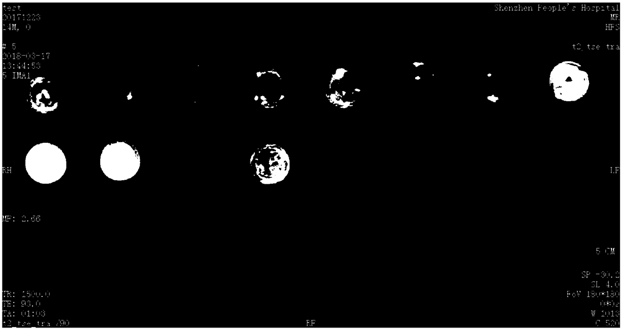 Short-T2-effect endorectal/endovaginal magnetic resonance imaging contrast agent and preparation method thereof