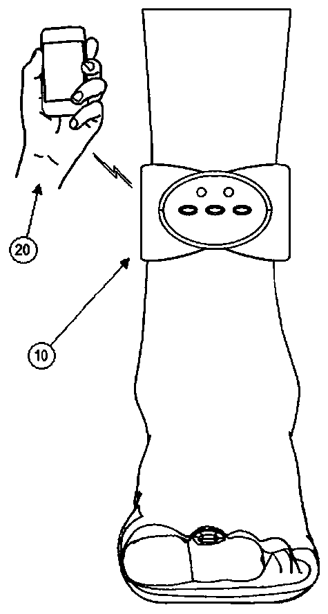 Wearable wireless intelligent posterior tibial nerve electrical stimulation system