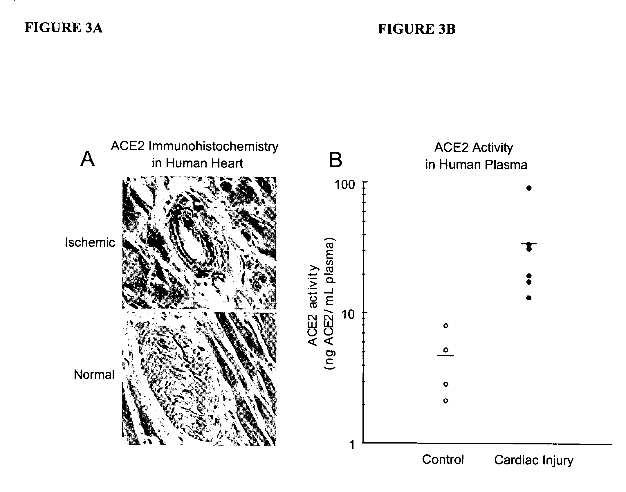 Detection of plasma ACE2