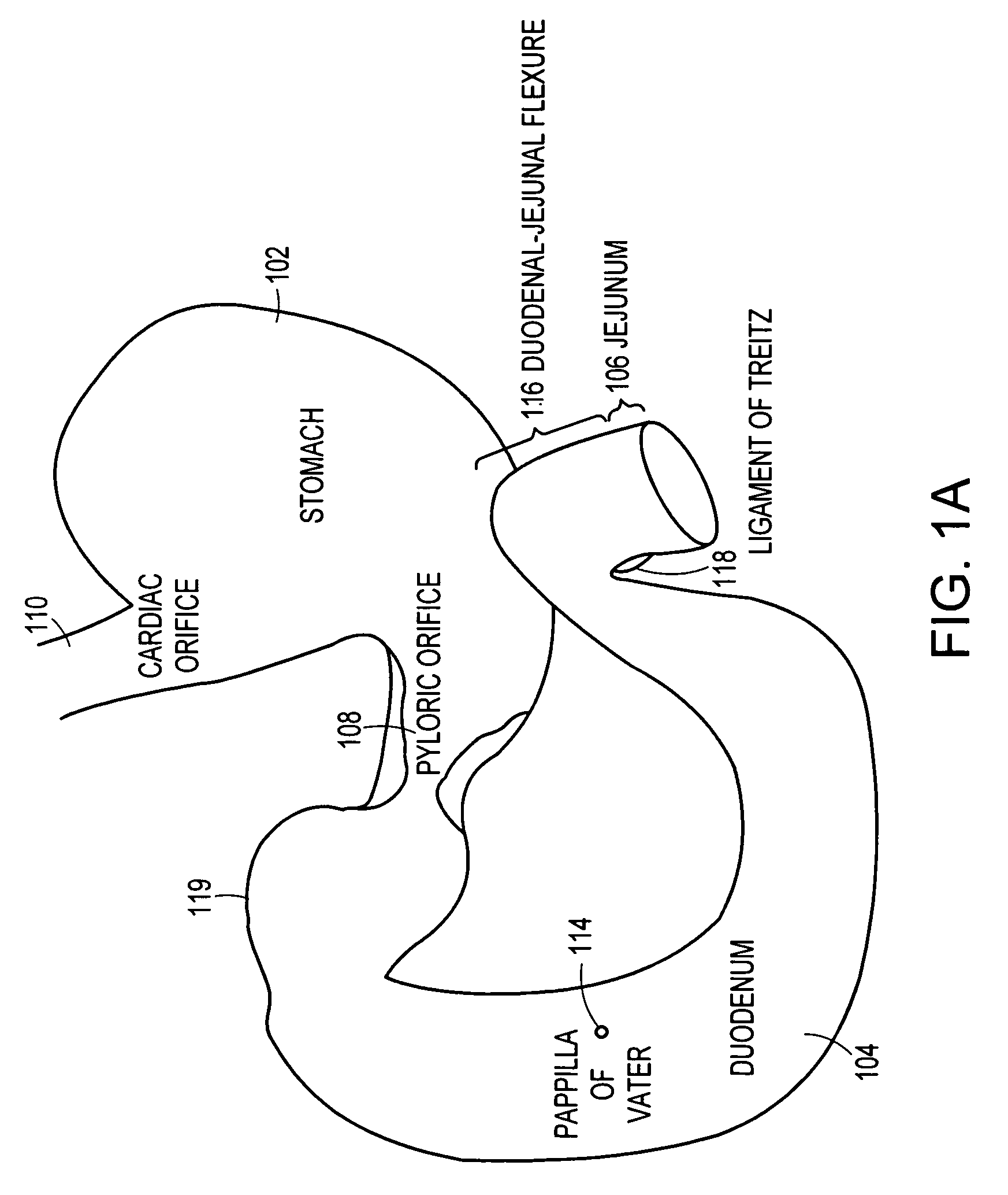 Gastrointestinal anchor compliance