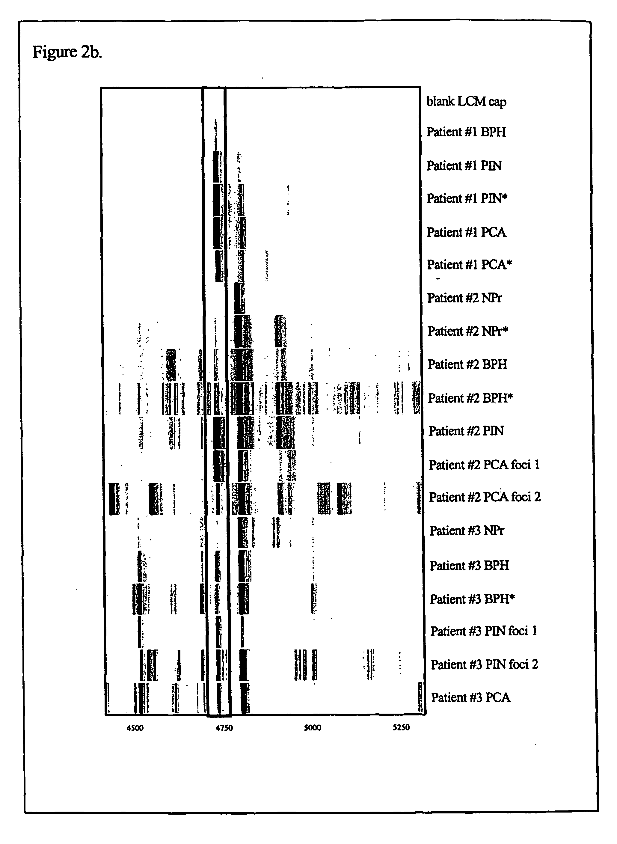 Protein biomarkers that distinguish prostate cancer from non-malignant cells