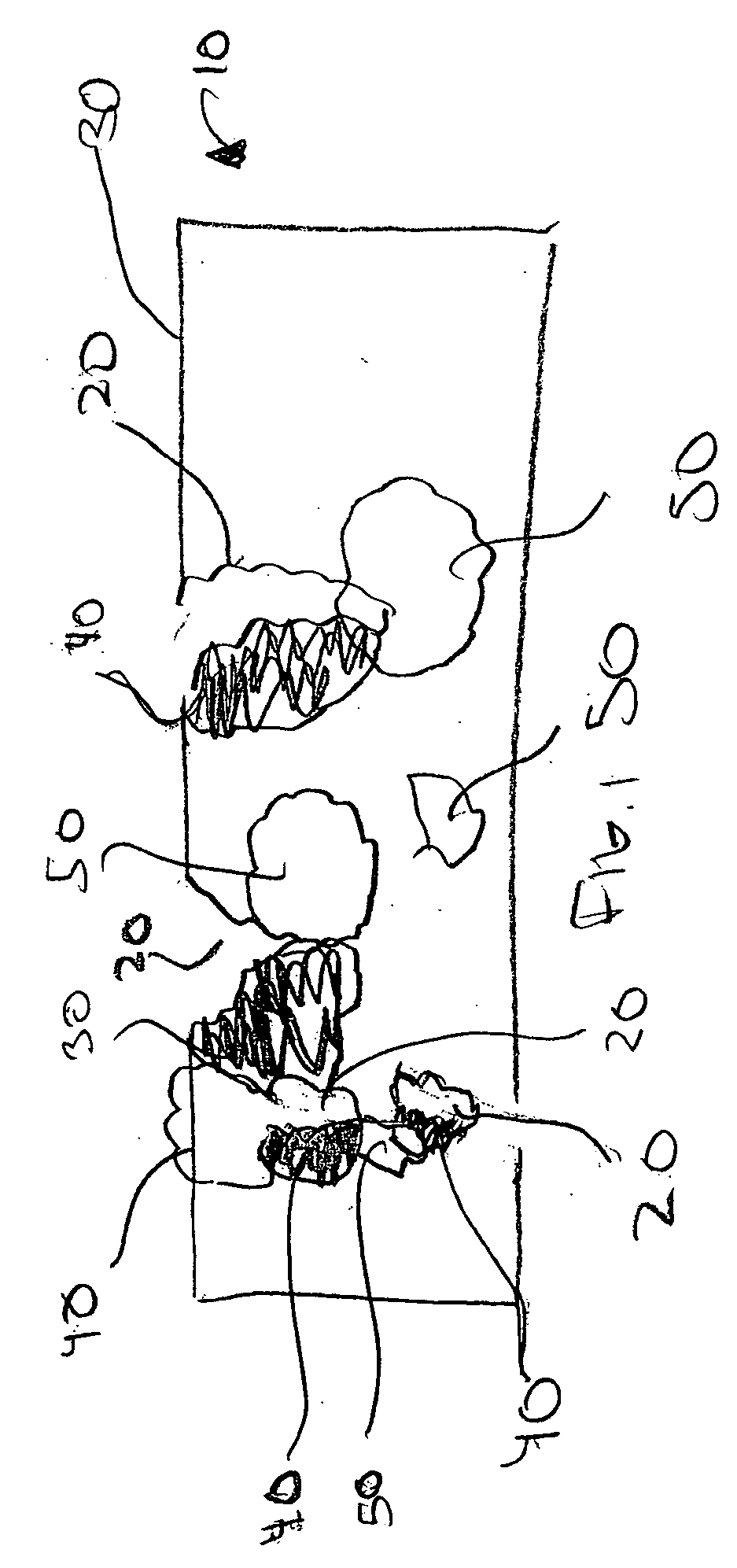 Method of manufacturing a medical device having a porous coating thereon