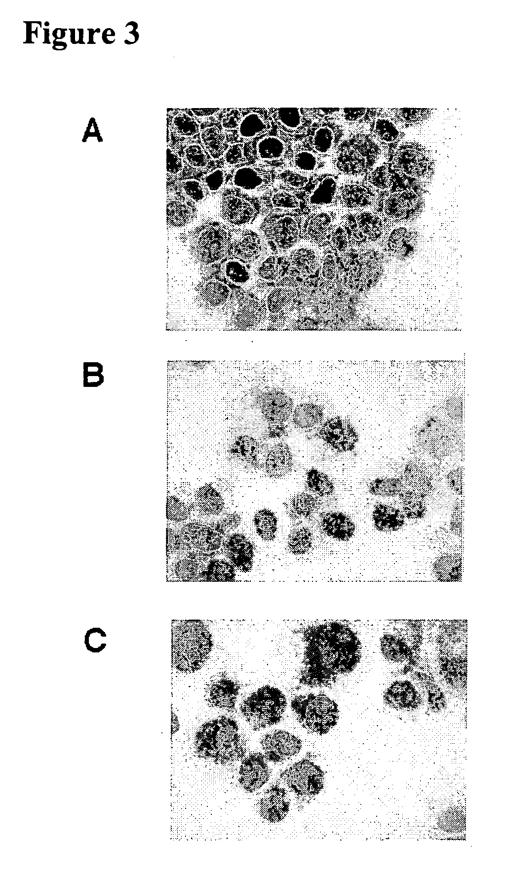 Control of gene expression