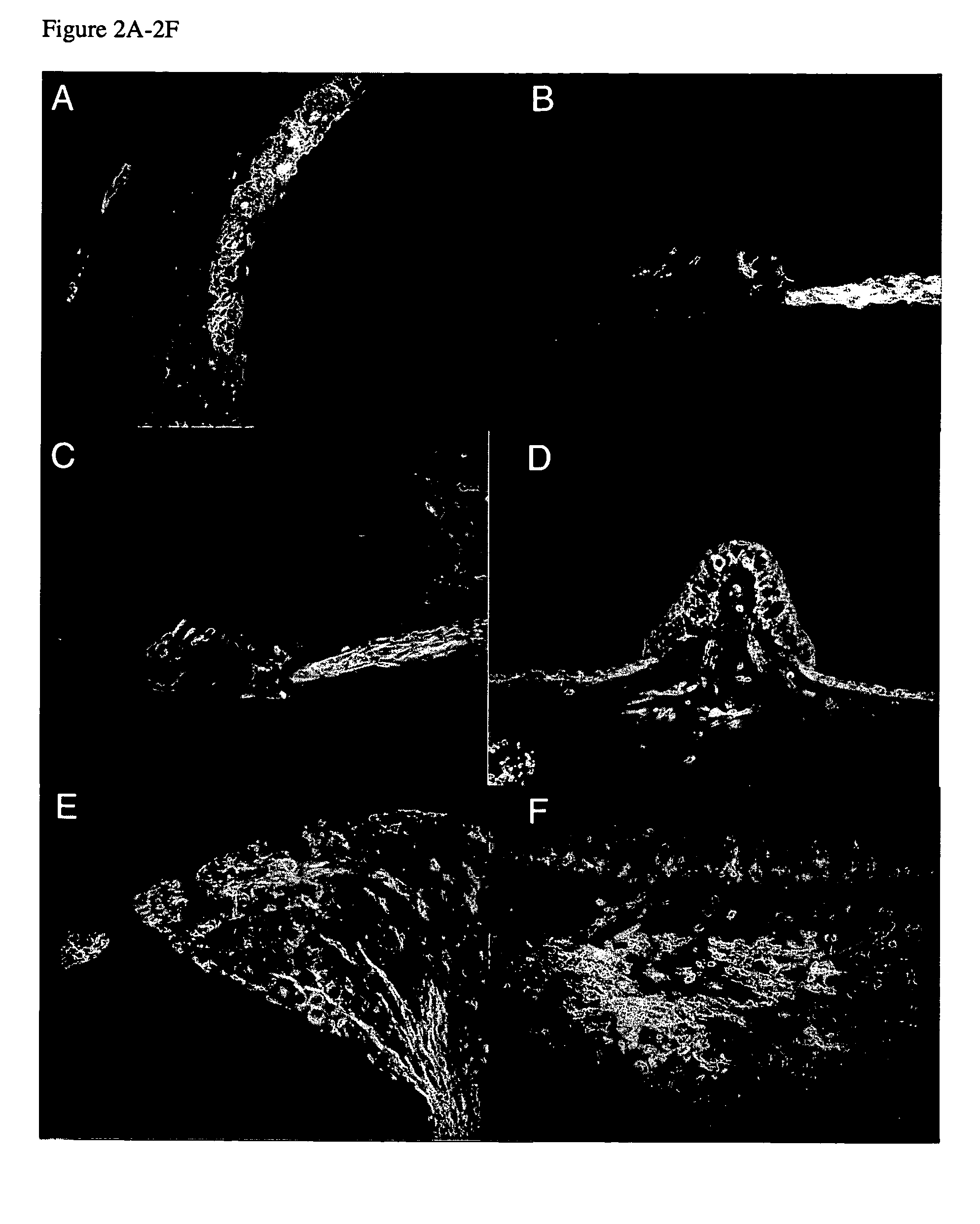 Drug delivery to the inner ear and methods of using same