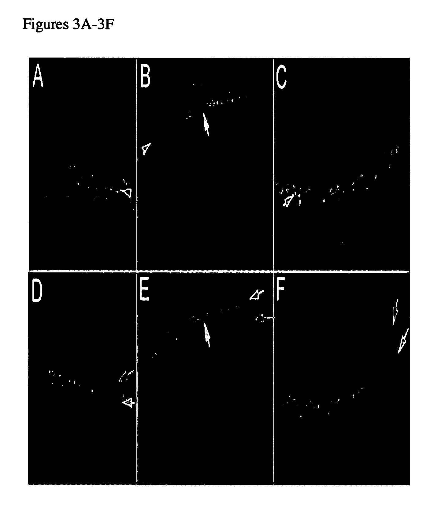 Drug delivery to the inner ear and methods of using same