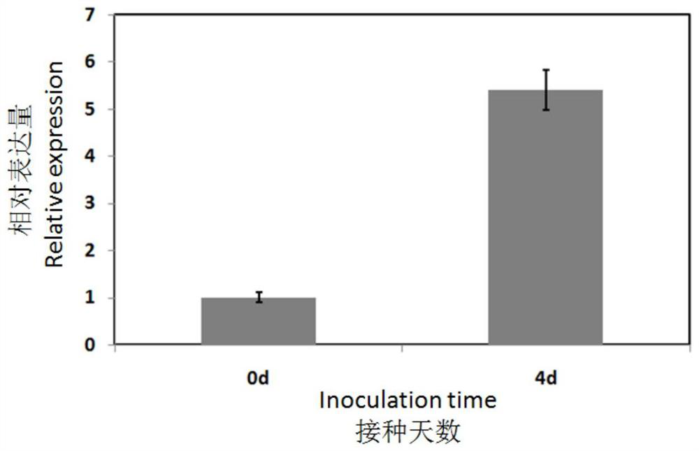 Application of ghmyb36 gene in improving plant resistance to Verticillium wilt