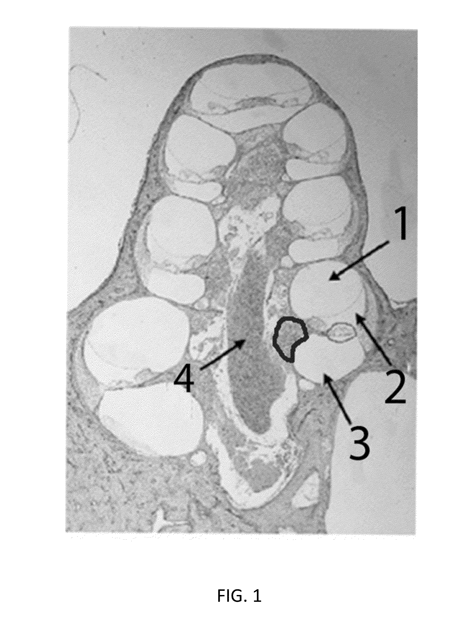 Local cochlear application of statins for stimulating neurite regrowth in the cochlea