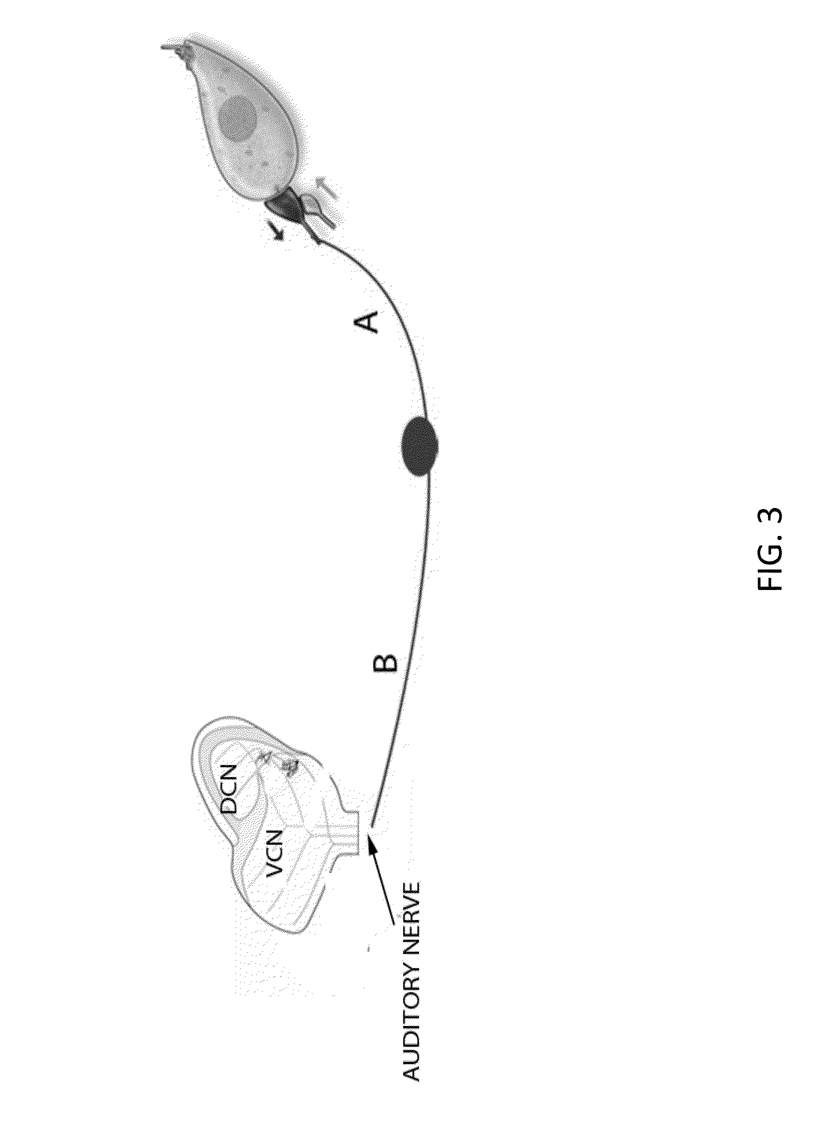 Local cochlear application of statins for stimulating neurite regrowth in the cochlea