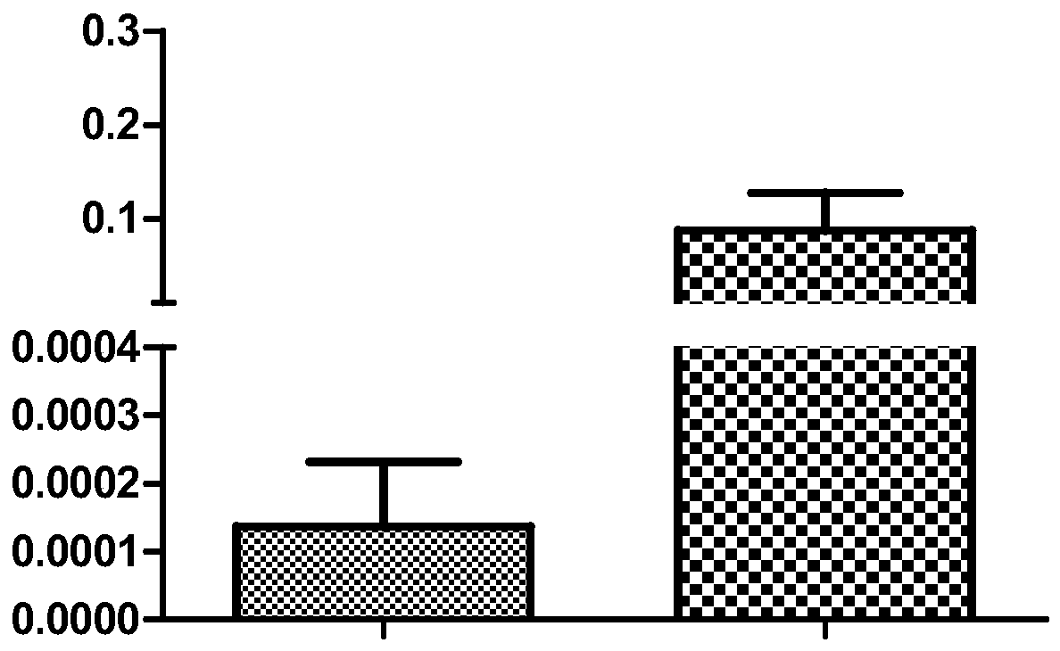 Application of dlk1 gene in preparation of diagnostic reagent for gastrointestinal stromal tumor