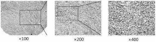 Application of dlk1 gene in preparation of diagnostic reagent for gastrointestinal stromal tumor