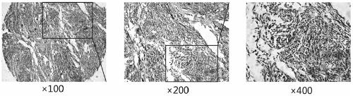 Application of dlk1 gene in preparation of diagnostic reagent for gastrointestinal stromal tumor