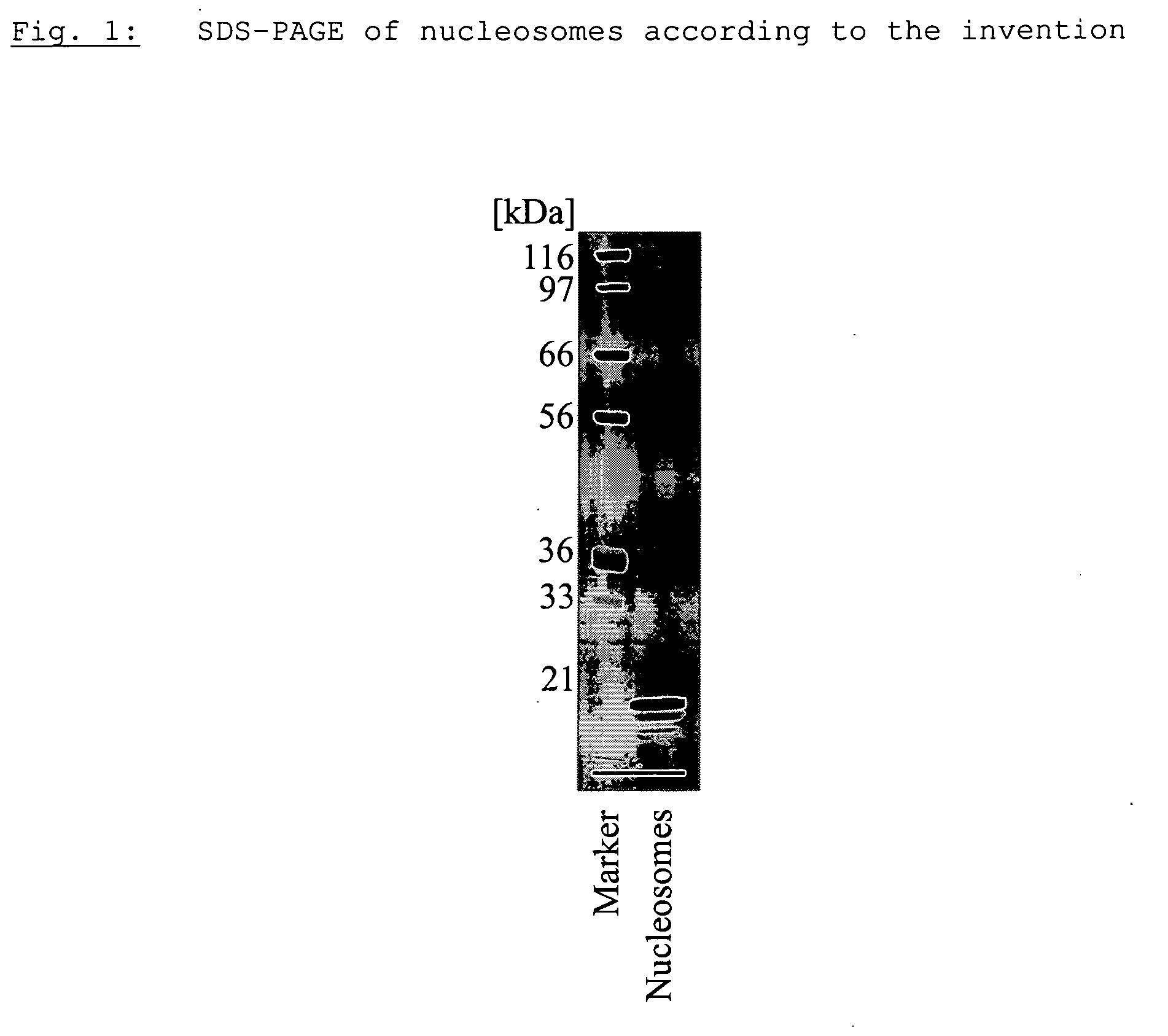 Method for producing a nucleosome preparation and use thereof in in vitro diagnosis of disseminated lupus erythematosus (dle)