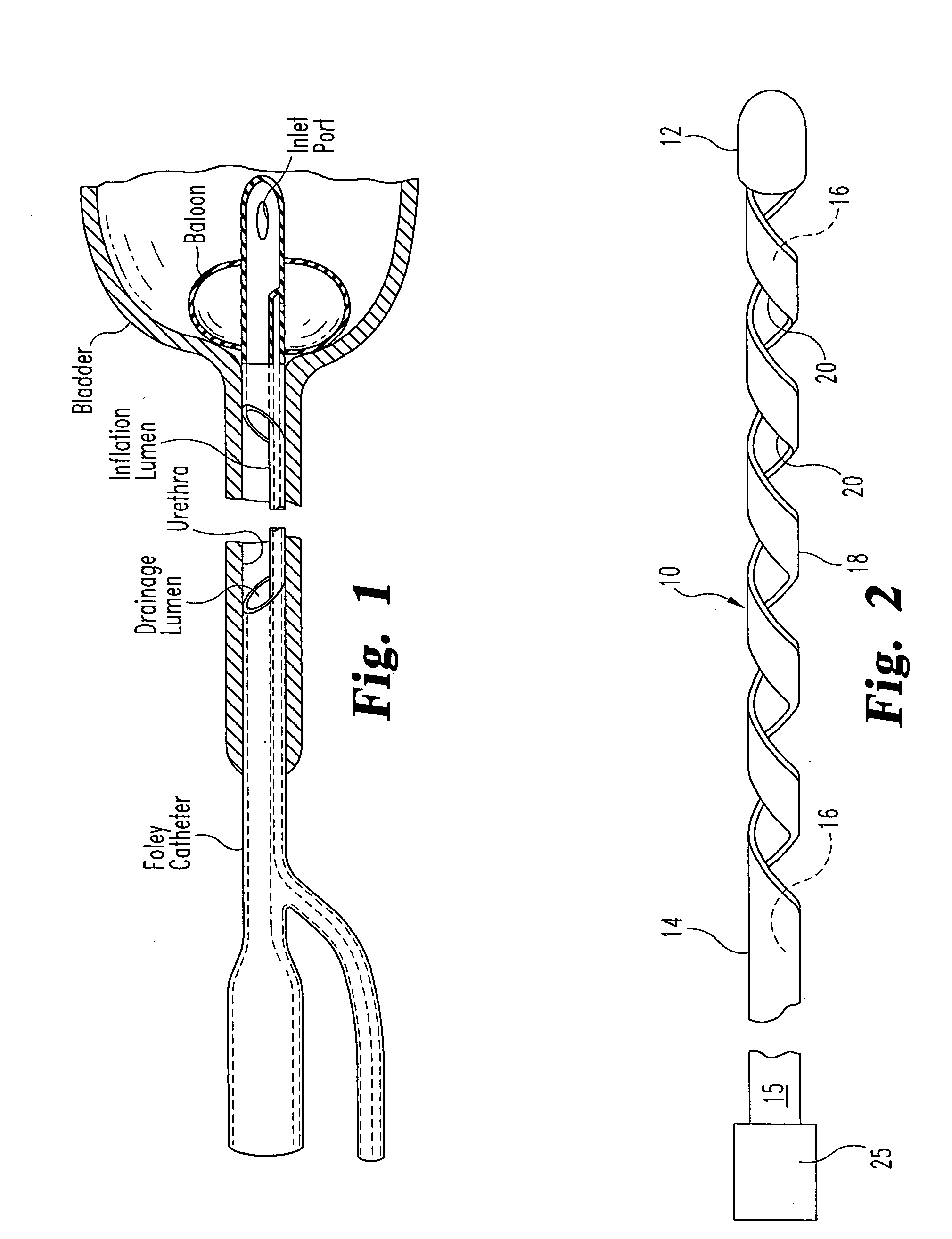 Self-Cleansing Bladder Drainage Catheter