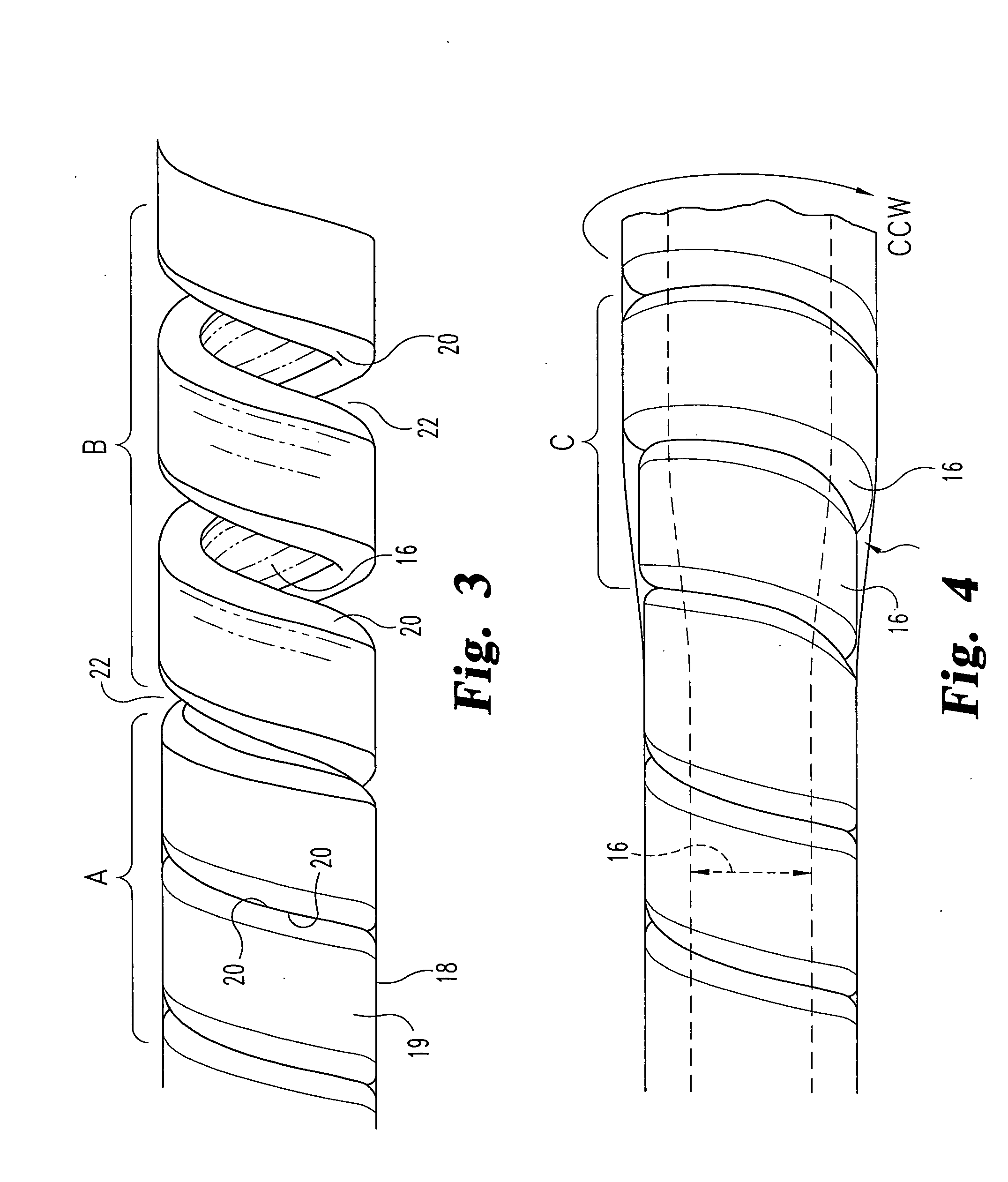 Self-Cleansing Bladder Drainage Catheter