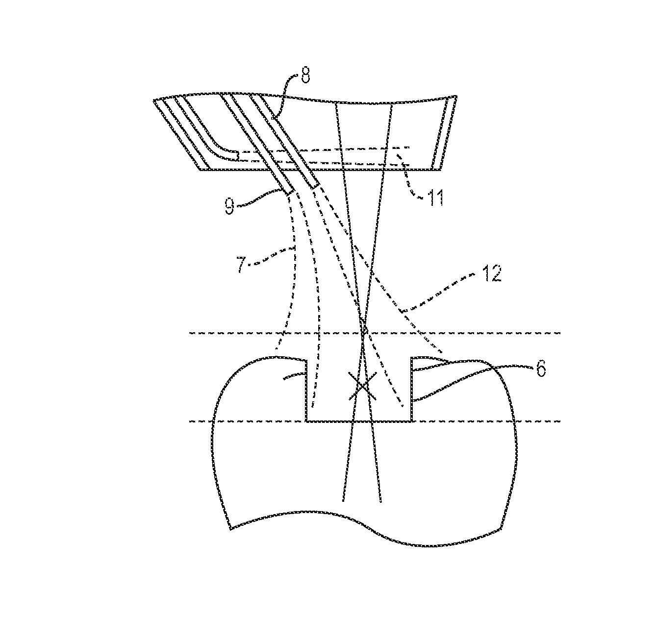 Apparatus and method for controlled fluid cooling during laser based dental treatments