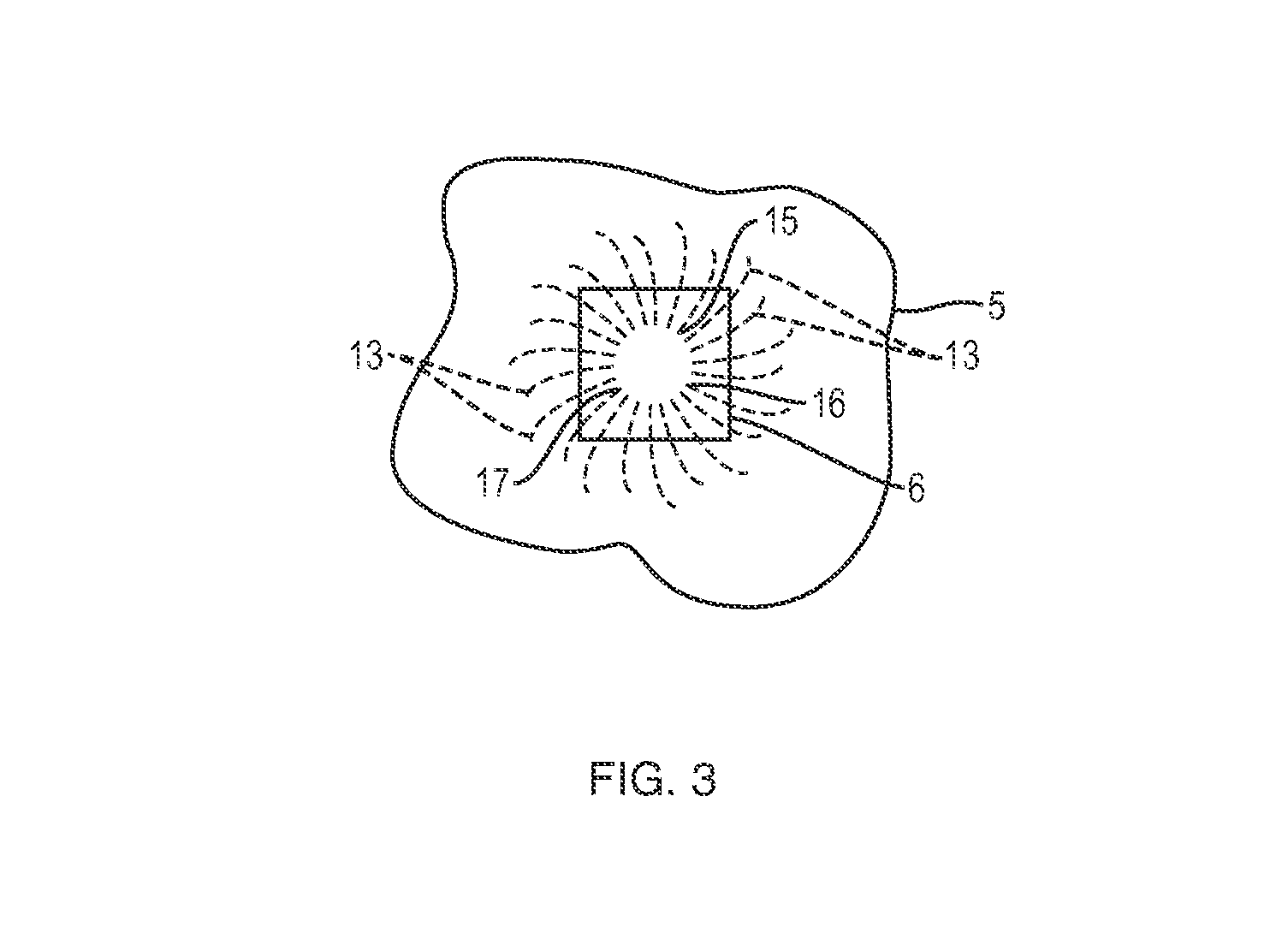 Apparatus and method for controlled fluid cooling during laser based dental treatments