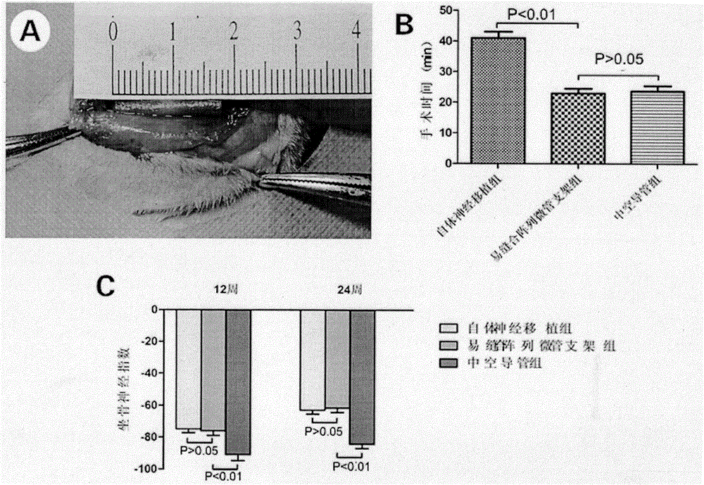 Preparation method and application of easy-to-suture array microtubular nerve regeneration stent