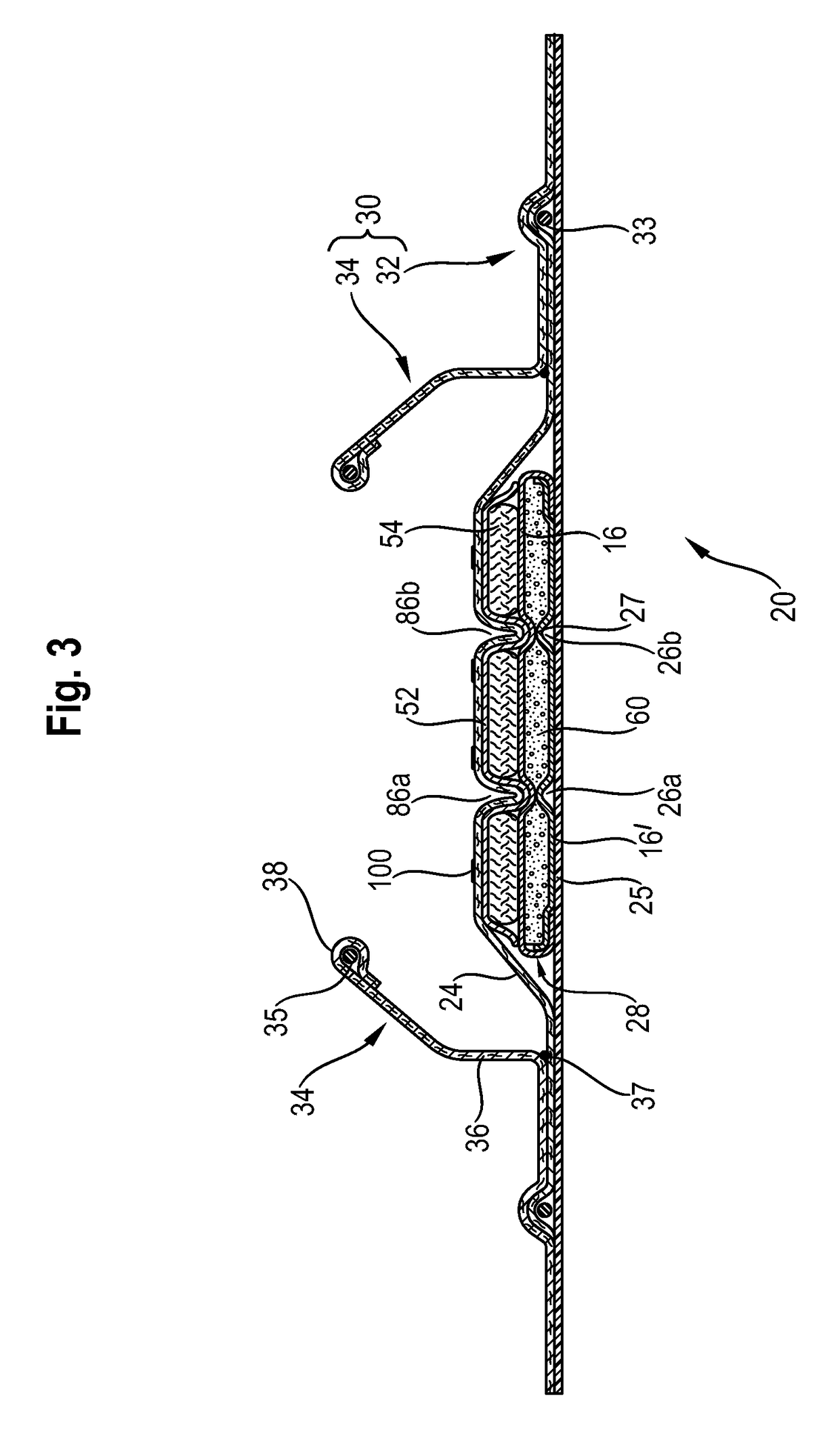 Absorbent article with a lotioned topsheet