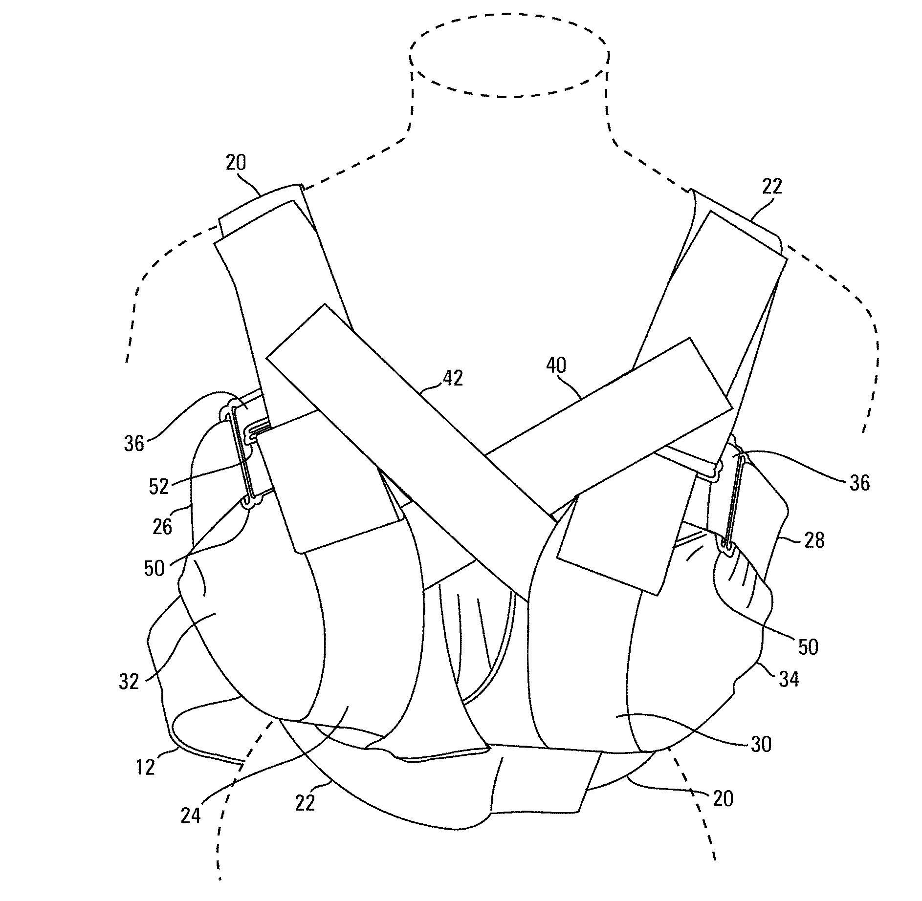 Post-operative sternum and breast device