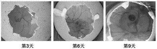 Antiaging nutrient composition and application