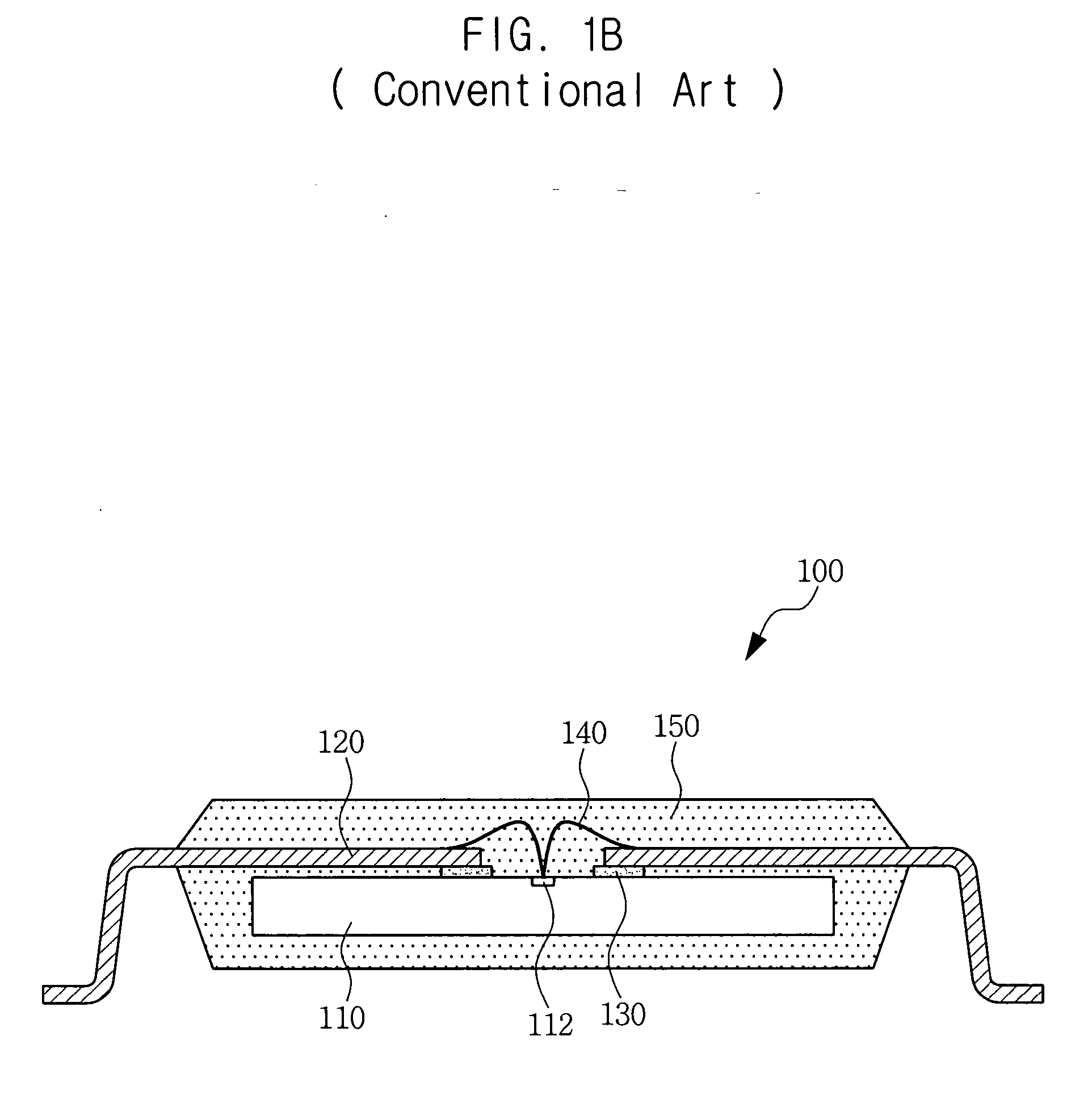 Leadframe package with dual lead configurations